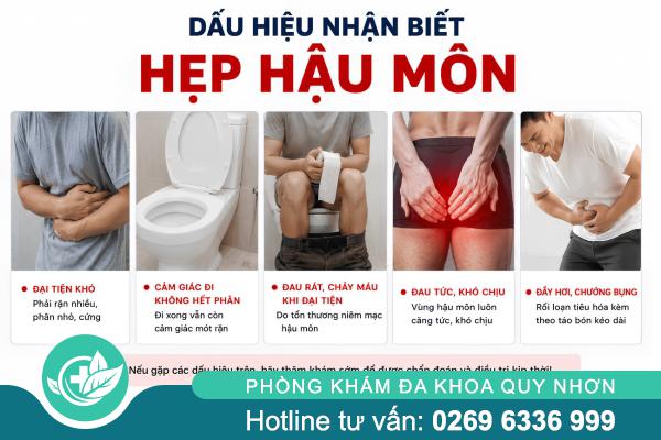 Hẹp hậu môn: Dấu hiệu nhận biết và phương pháp chữa trị hiệu quả