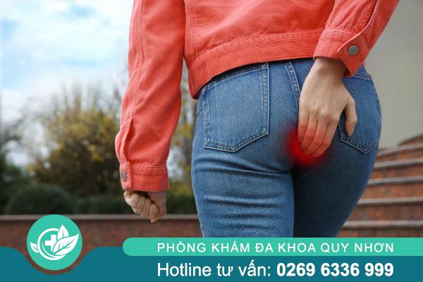 Hạch Hậu Môn Có Nguy Hiểm Không? Khi Nào Cần Đi Khám?