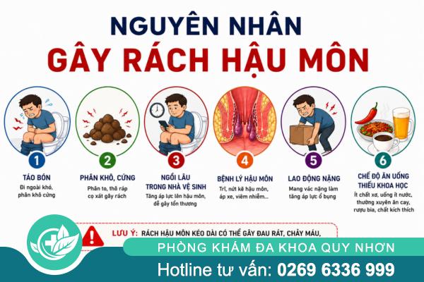 Rách hậu môn: Tưởng nhẹ nhưng có thể gây nhiều nguy hiểm