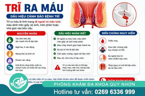 Trĩ Ra Máu Có Nguy Hiểm Không? Cần Làm Gì Khi Bị?